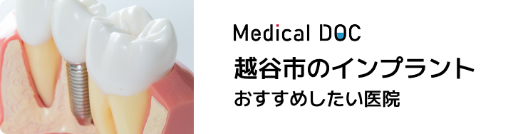 越谷市のインプラントおすすめしたい医院