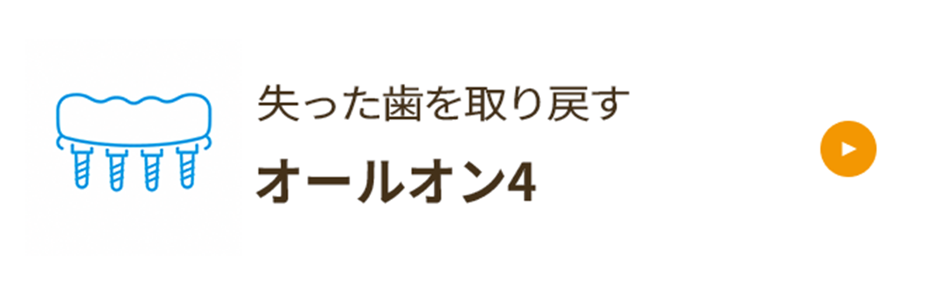 オールオン4